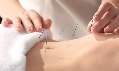 acupuncture courses